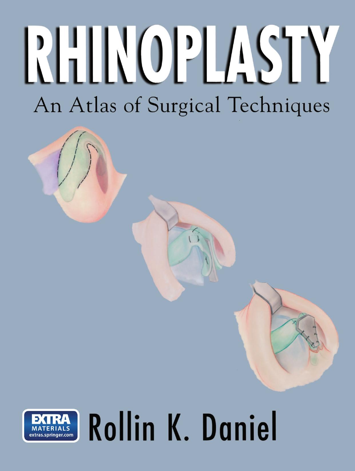 Rhinoplasty: An Atlas of Surgical Techniques by Rollin K. Daniel MD (auth.)