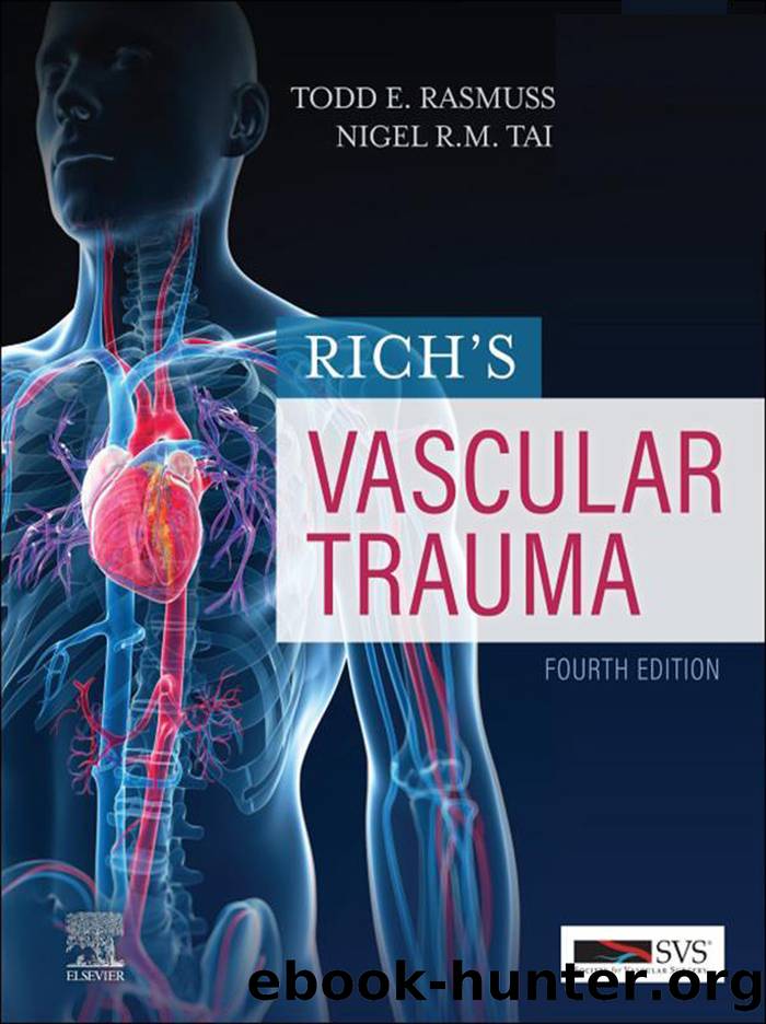 Rich's Vascular Trauma E-Book by unknow