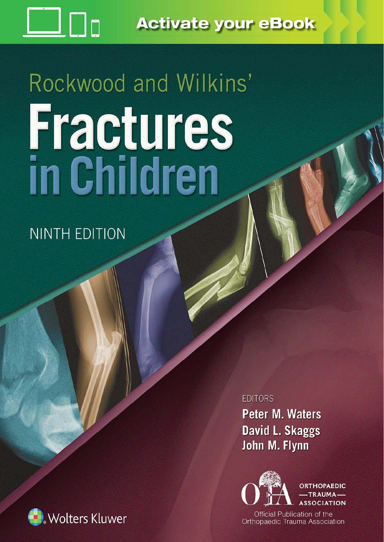 Rockwood and Wilkins Fractures in Children by Peter M Waters; David L Skaggs; John M Flynn
