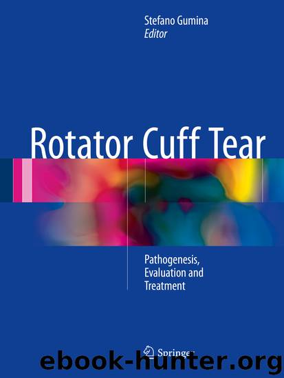 Rotator Cuff Tear by Stefano Gumina
