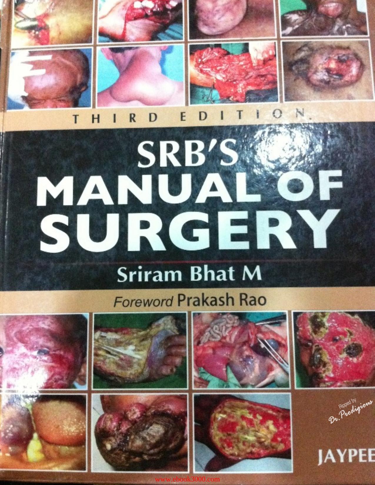 SRB's Manual of Surgery, 3rd edition by Unknow