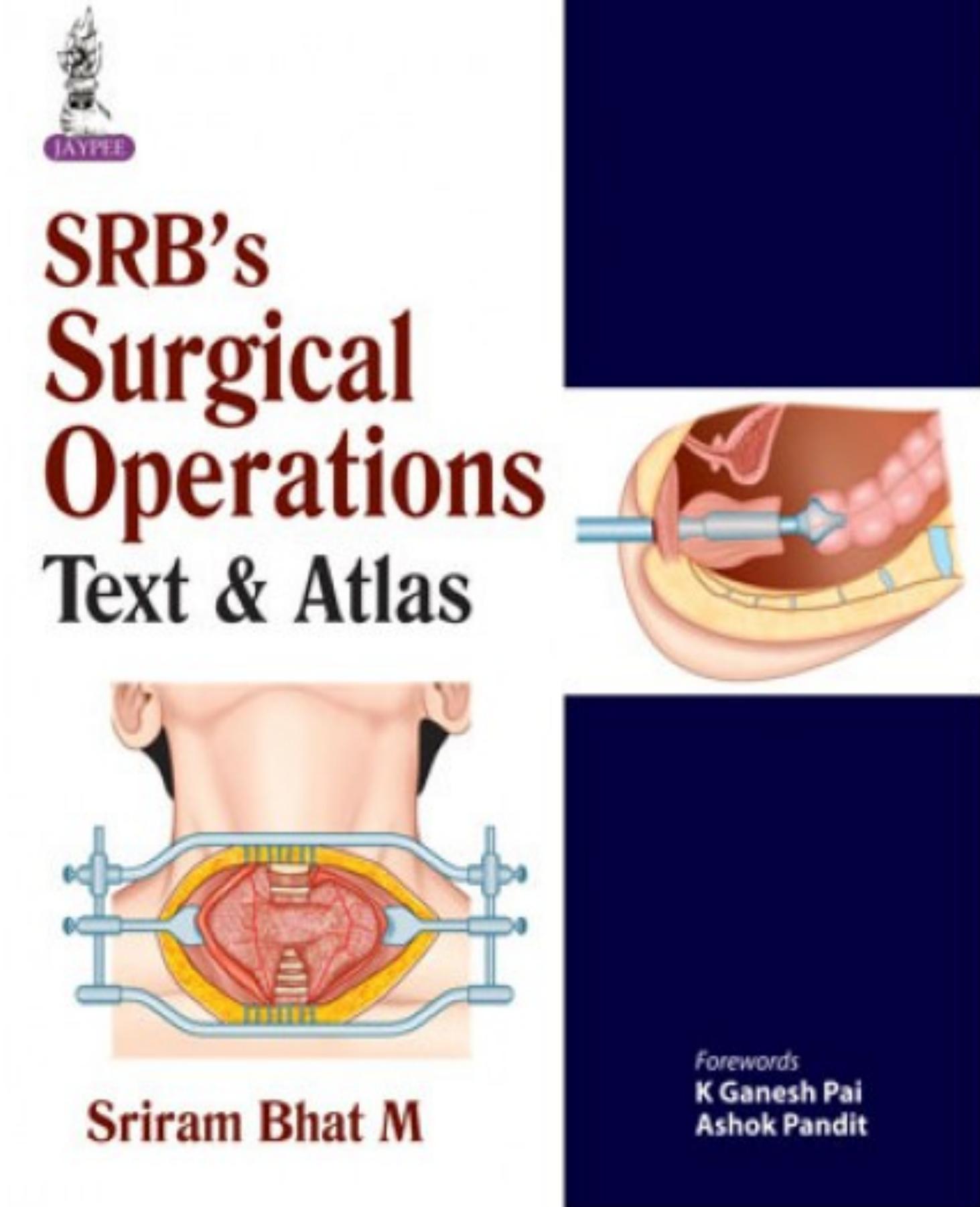 SRB's surgical operations : text and atlas by Sriram Bhat M