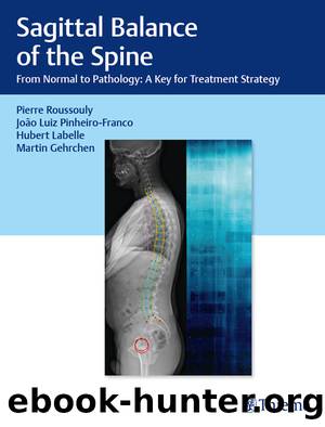 Sagittal Balance of the Spine by Roussouly Pierre;Labelle Hubert;Pinheiro-Franco Joao Luiz;