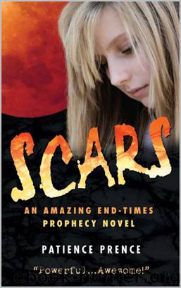 Scars by Patience Prence