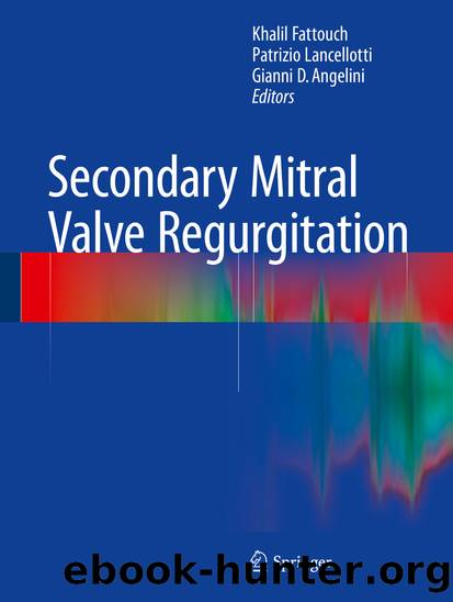 Secondary Mitral Valve Regurgitation by Khalil Fattouch Patrizio Lancellotti & Gianni D. Angelini