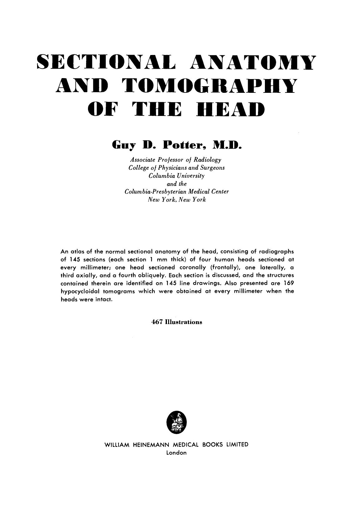 Sectional Anatomy and Tomography of the Head by Guy D. Potter (Auth.)