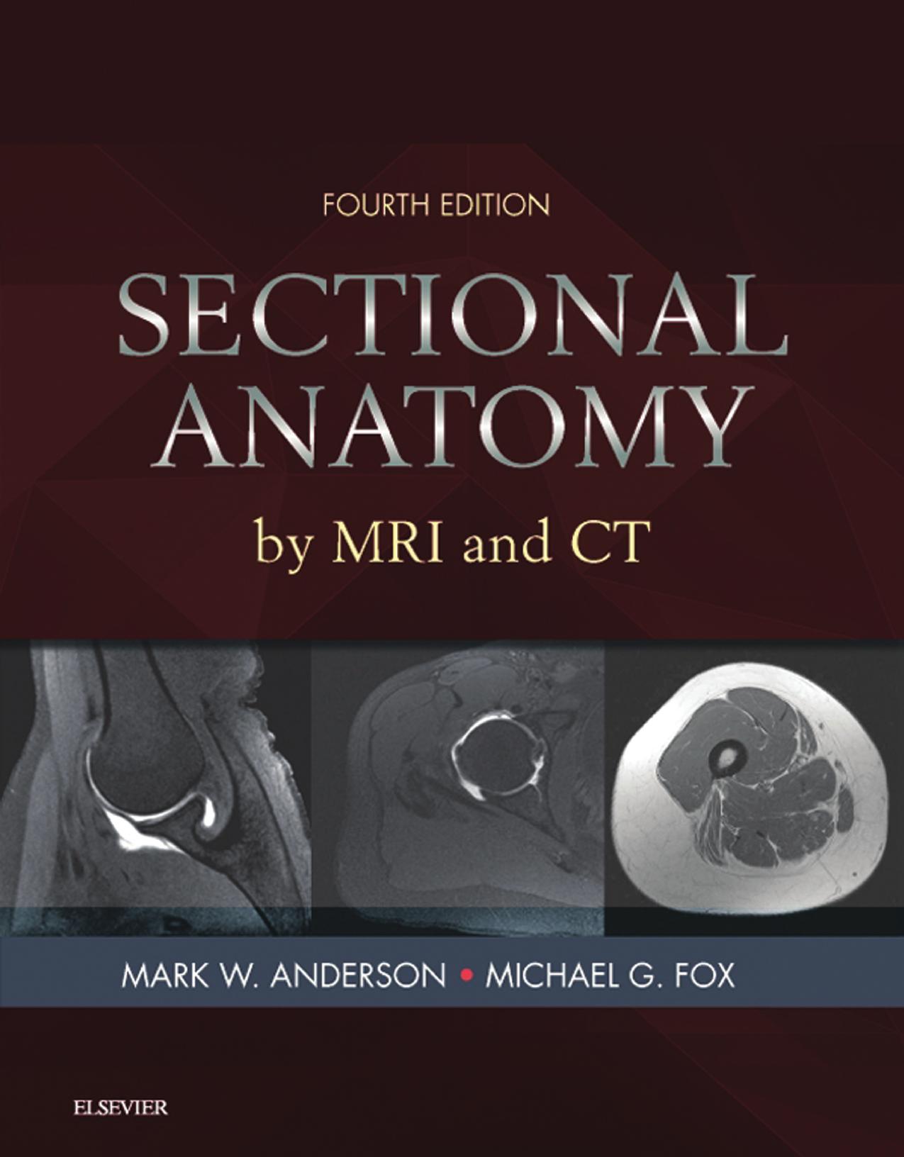 Sectional Anatomy by MRI and CT by Mark W. Anderson MD Michael G Fox MD