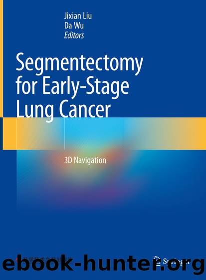 Segmentectomy for Early-Stage Lung Cancer: 3D Navigation by Jixian Liu & Da Wu