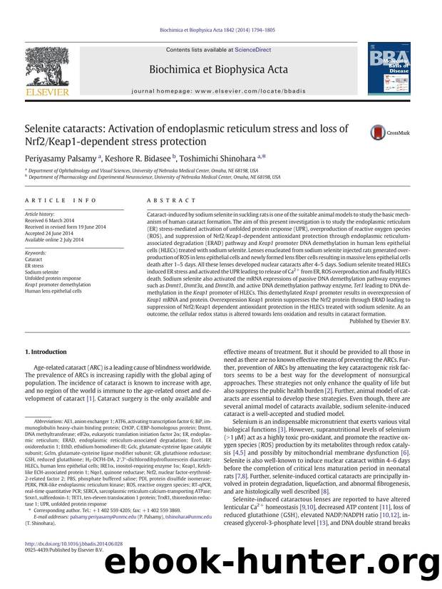 Selenite cataracts: Activation of endoplasmic reticulum stress and loss of Nrf2Keap1-dependent stress protection by Periyasamy Palsamy & Keshore R. Bidasee & Toshimichi Shinohara