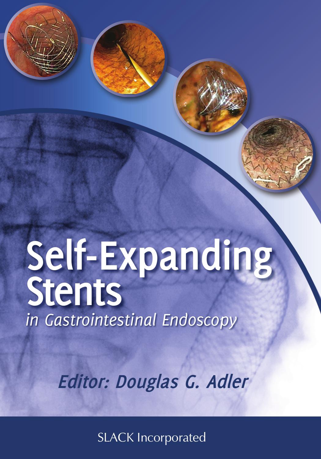 Self-Expanding Stents in Gastroenterology by Douglas Adler