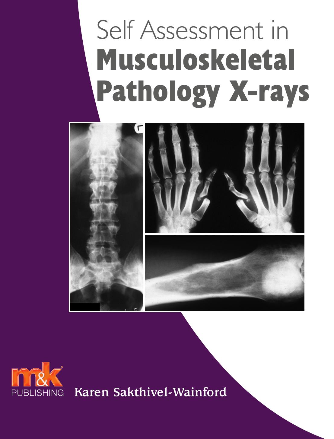 Self-assessment in axial skeleton musculoskeletal trauma X-rays by Sakthivel-Wainford Karen
