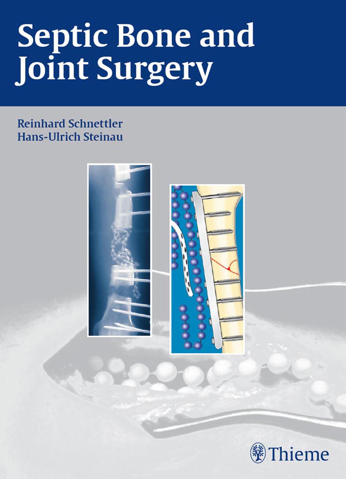 Septic Bone and Joint Surgery by Unknow