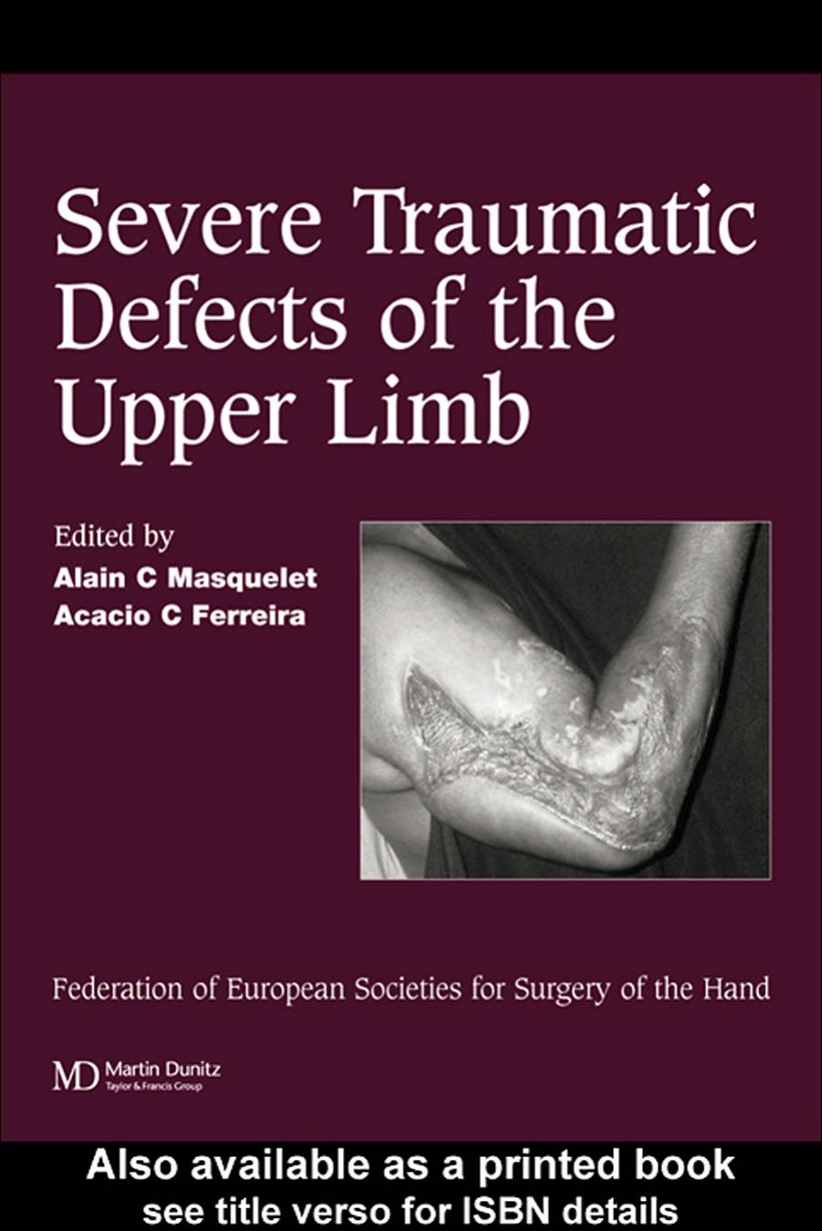 Severe Tramatic Defects of the Upper Limb: Published in association with the Federation of European Societies for Surgery of the Hand by Alain C Masquelet; Acacio C Ferreira; Federation of European Societies for Surgery of the Hand