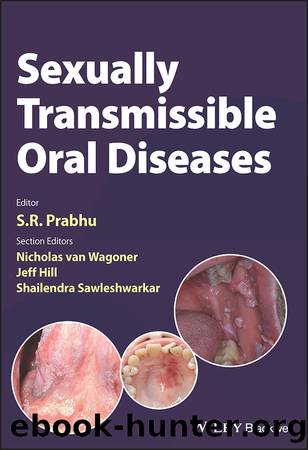 Sexually Transmissible Oral Diseases by Prabhu S. R.;Van Wagoner Nicholas;Hill Jeff;Sawleshwarkar Shailendra;