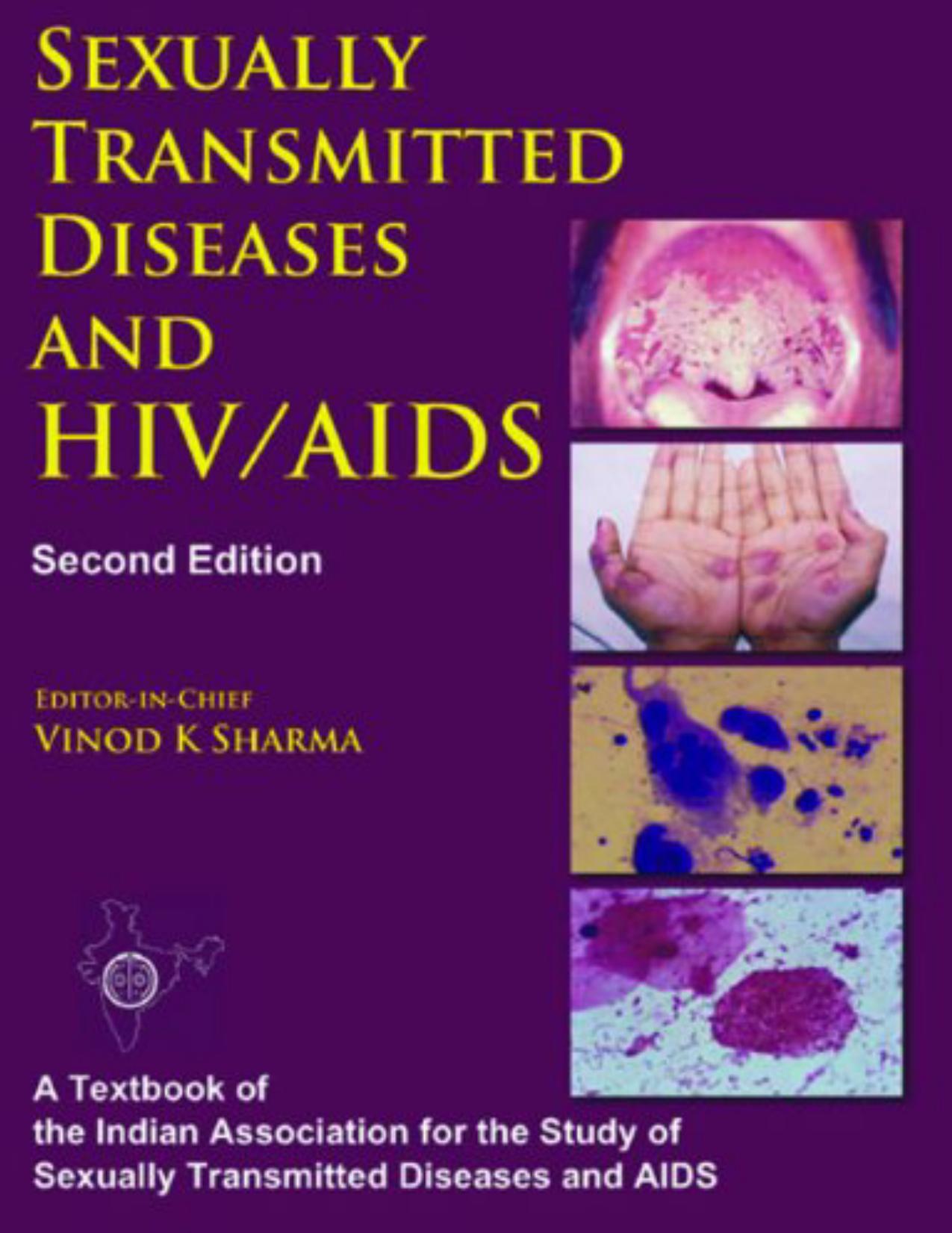 Sexually Transmitted Diseases and HIV/AIDS by Vinod K. Sharma