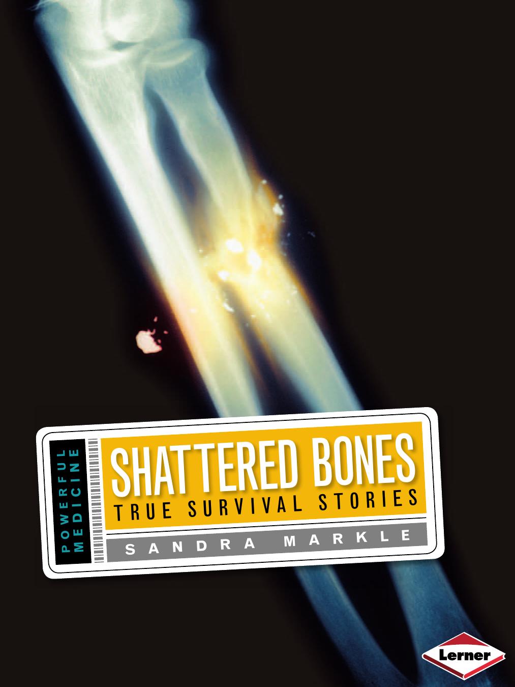 Shattered Bones: True Survival Stories (Powerful Medicine) by Sandra Markle