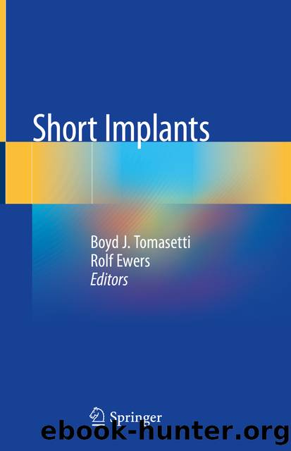 Short Implants by Unknown
