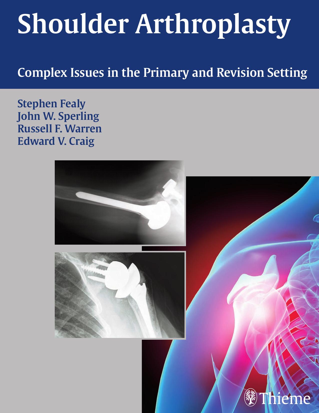 Shoulder arthroplasty: complex issues in the primary and revision setting by Stephen Fealy John W. Sperling Russell F. Warren Edward V. Craig