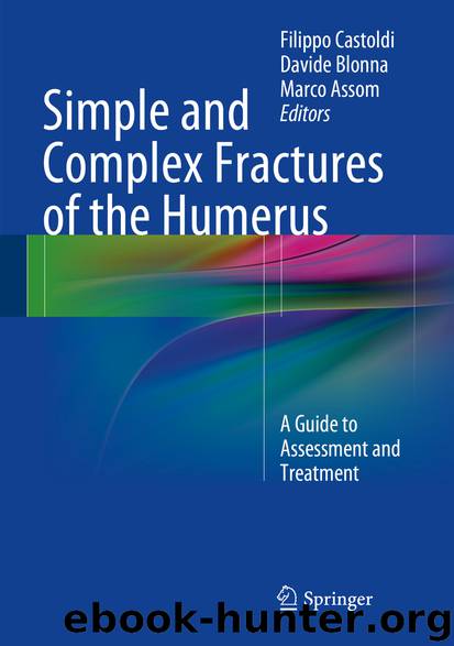 Simple and Complex Fractures of the Humerus by Filippo Castoldi Davide Blonna & Marco Assom