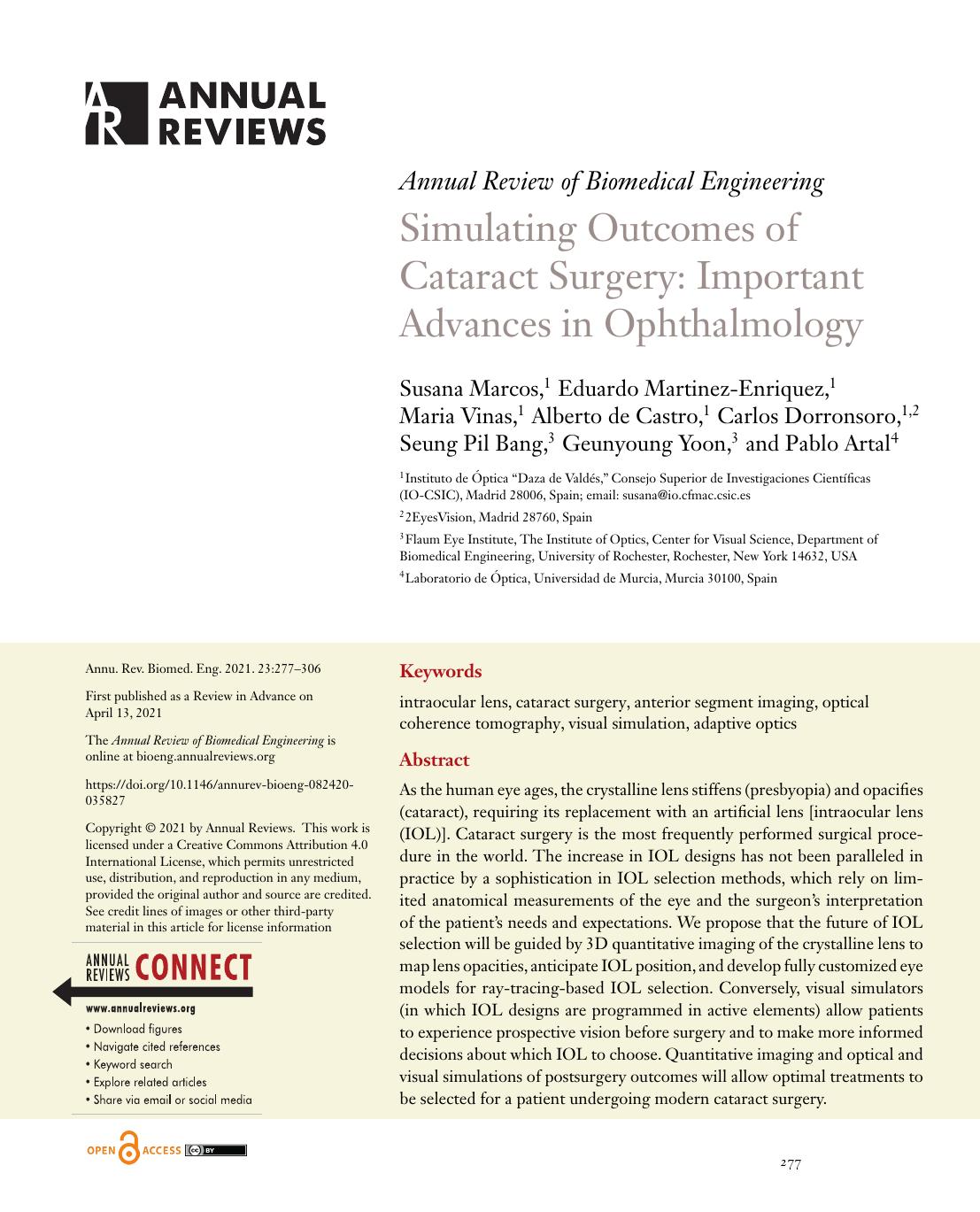 Simulating Outcomes of Cataract Surgery: Important Advances in Ophthalmology by unknow