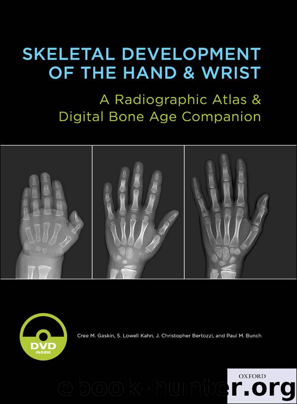 Skeletal Development of the Hand and Wrist by Gaskin Cree M.; Kahn S. Lowell MD MBA; Bertozzi J. Christoper