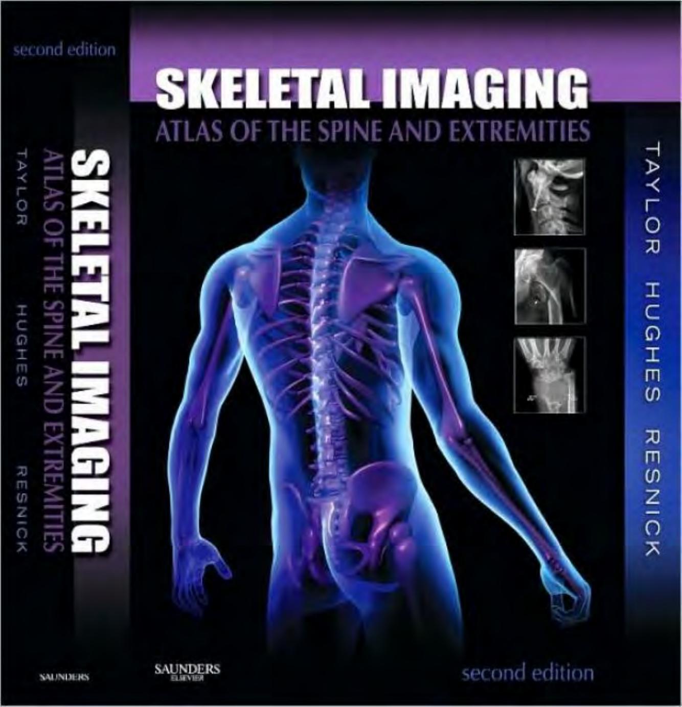 Skeletal Imaging: Atlas of the Spine and Extremities, Second Edition by John A. M. Taylor Tudor H. Hughes Donald Resnick