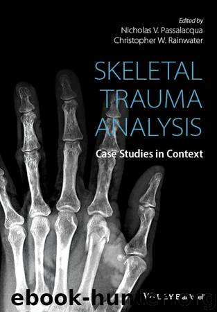 Skeletal Trauma Analysis by Nicholas V. Passalacqua Christopher W. Rainwater