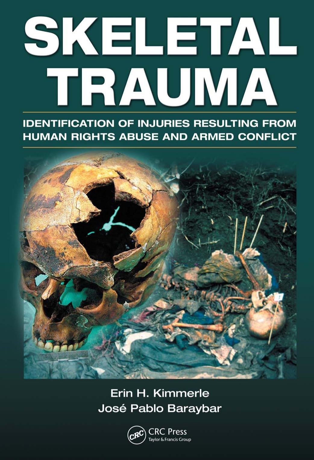 Skeletal Trauma: Identification of Injuries Resulting from Human Rights Abuse and Armed Conflict by Erin H. Kimmerle Jose Pablo Baraybar