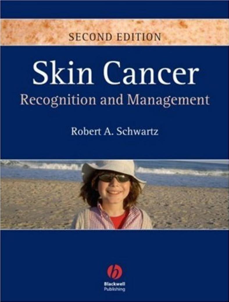 Skin cancer : recognition and management by Robert A. Schwartz