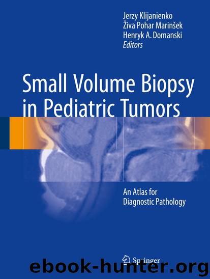 Small Volume Biopsy in Pediatric Tumors by Jerzy Klijanienko Živa Pohar Marinšek & Henryk A Domanski