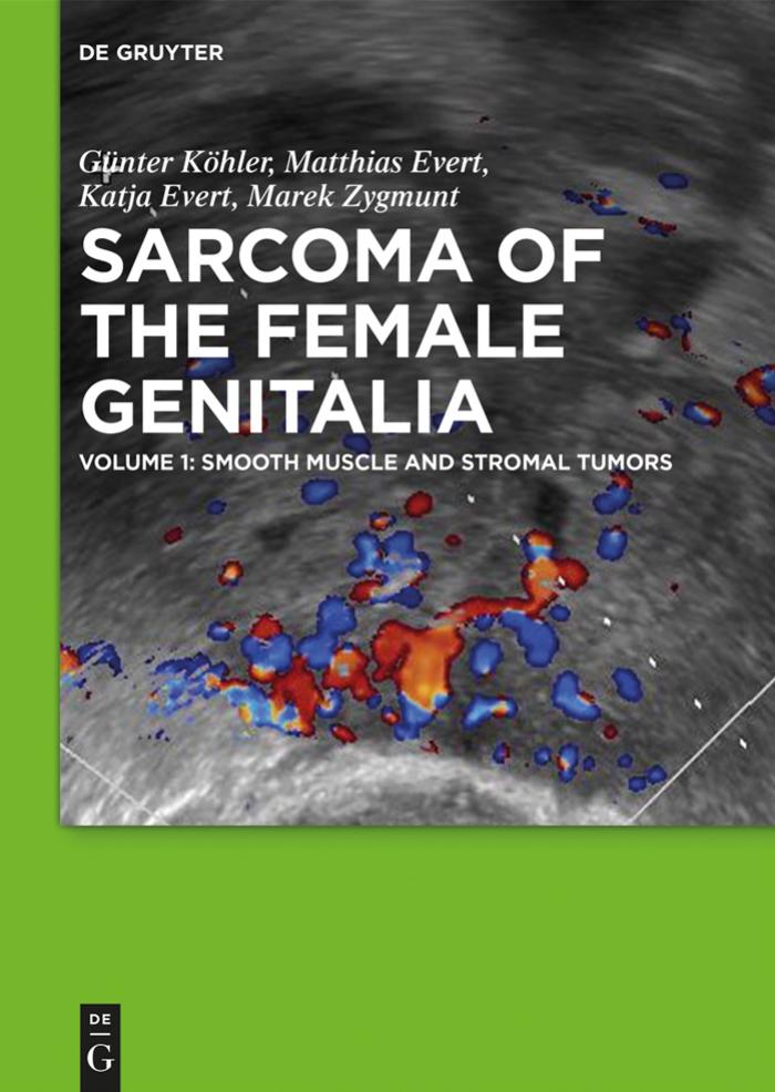 Smooth Muscle and Stromal Tumors and Prevention of Inadequate Surgery by Unknow