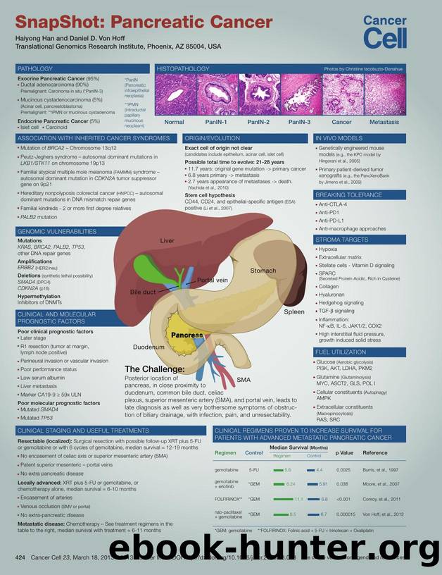 SnapShot: Pancreatic Cancer by Haiyong Han & Daniel D. Von Hoff