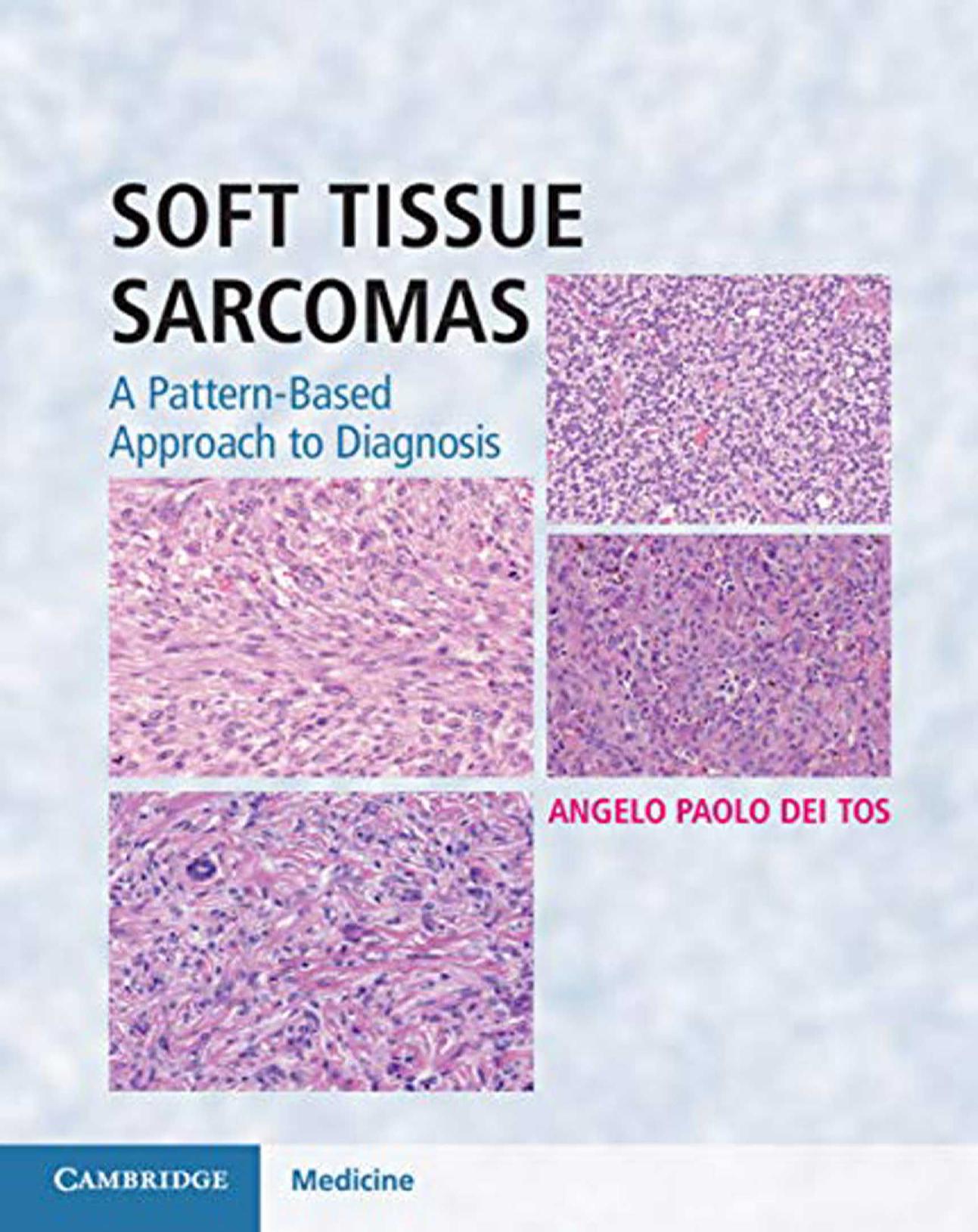 Soft Tissue Sarcomas Hardback with Online Resource: A Pattern-Based Approach to Diagnosis by Angelo Paolo Dei Tos