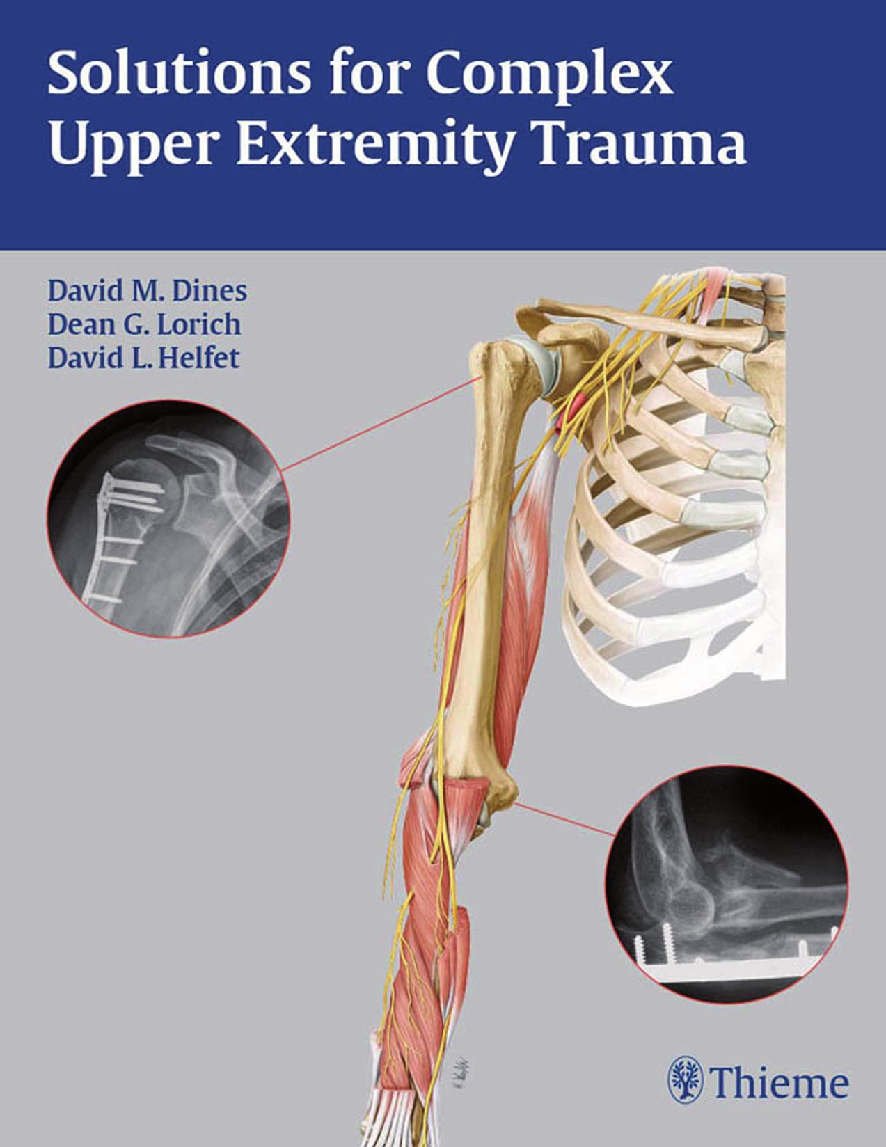 Solutions for complex upper extremity trauma by Dines David M.; Lorich Dean G.; Helfet David L