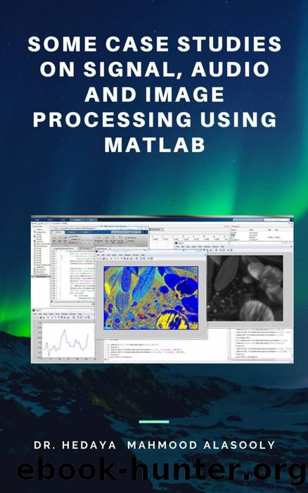 Some Case Studies on Signal, Audio and Image Processing Using Matlab by Dr. Hedaya Mahmood Alasooly