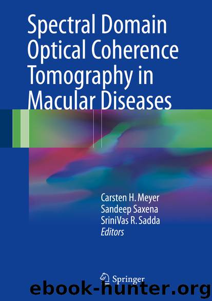 Spectral Domain Optical Coherence Tomography in Macular Diseases by Carsten H. Meyer Sandeep Saxena & SriniVas R Sadda