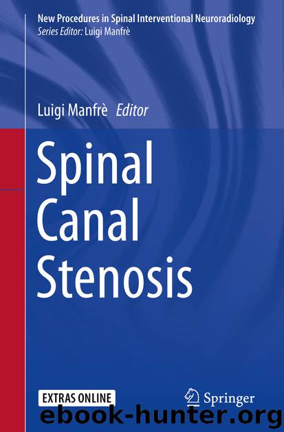 Spinal Canal Stenosis by Luigi Manfrè