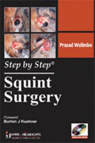 Squint Surgery by Prasad Walimbe