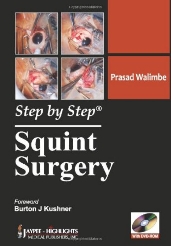 Squint surgery by Walimbe Prasad