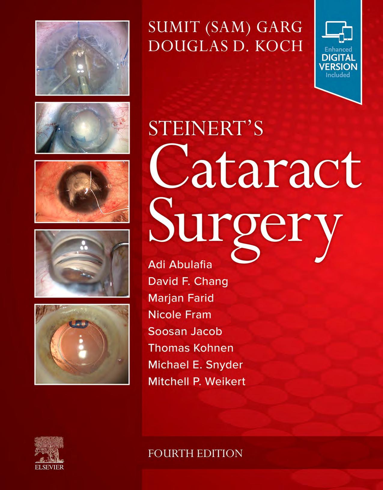 Steinert's Cataract Surgery by Sumit Garg Douglas D. Koch