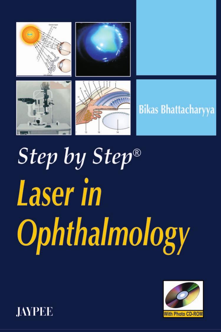 Step by Step® Laser in Ophthalmology by Bikas Bhattacharyya