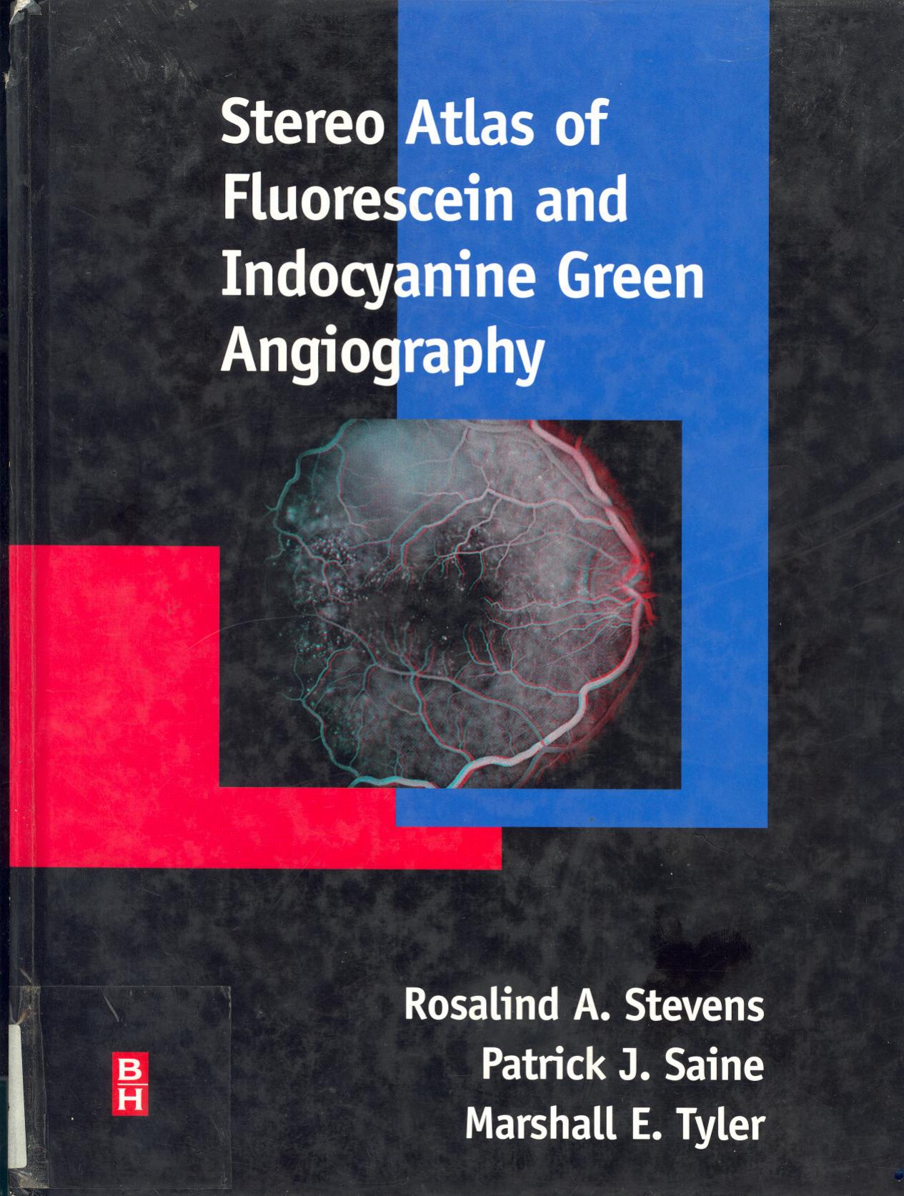 Stereo atlas of fluorescein and indocyanine green angiography by Marshall E. Tyler Rosalind A. Stevens Patrick J. Saine