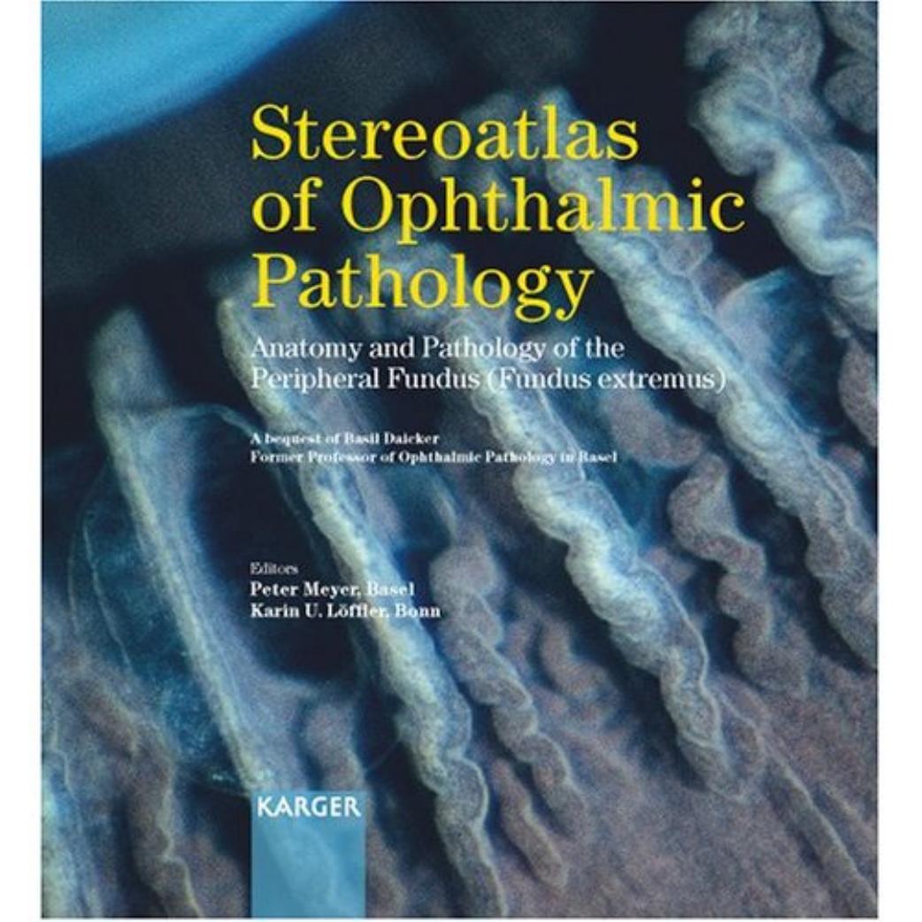 Stereoatlas of Ophthalmic Pathology: Anatomy and Pathology of the Peripheral Fundus ( Fundus extremus) by Peter Meyer Karin U. Loeffler