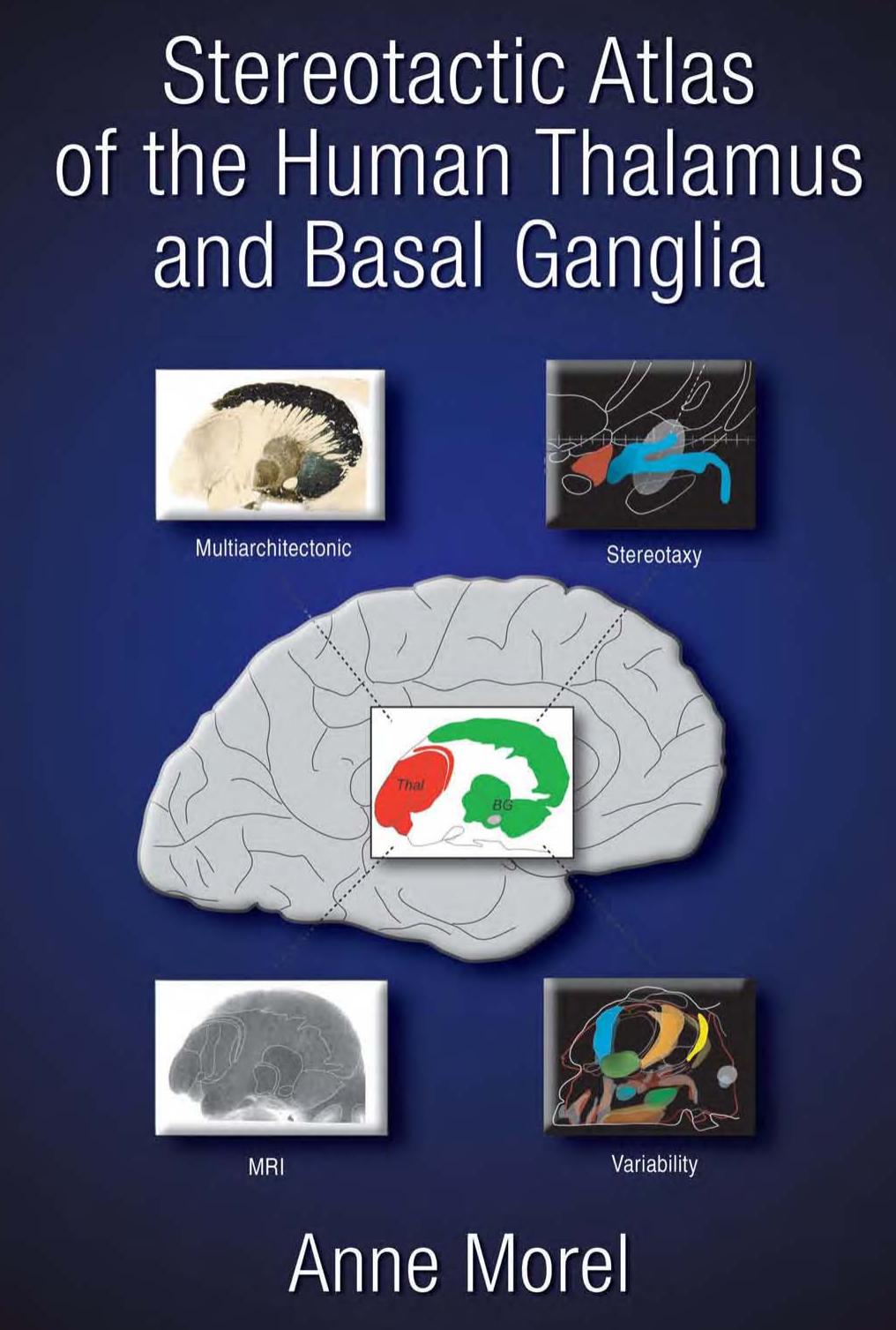 Stereotactic Atlas of the Human Thalamus and Basal Ganglia by Morel Anne