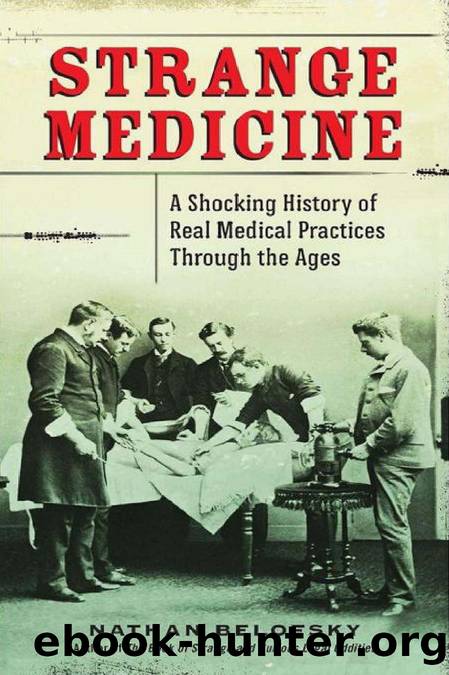 Strange Medicine - A Shocking History of Real Medical Practices Through the Ages by Nathan Belofsky