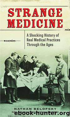 Strange Medicine: A Shocking History of Real Medical Practices Through the Ages by Nathan Belofsky