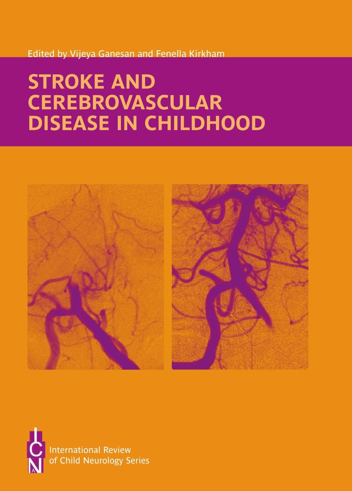 Stroke and Cerebrovascular Disease in Childhood by Vijeya Ganesan; Fenella Kirkham