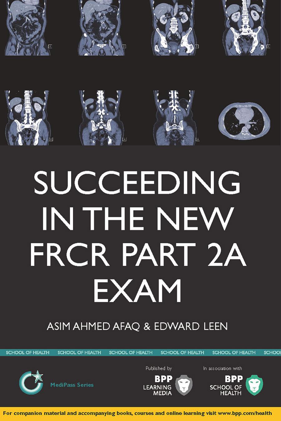 Succeeding in the New FRCR Part 2a Exam: Single Best Answer (SBA) Revision Questions for Modules 1-6 by Professor Edward Leen