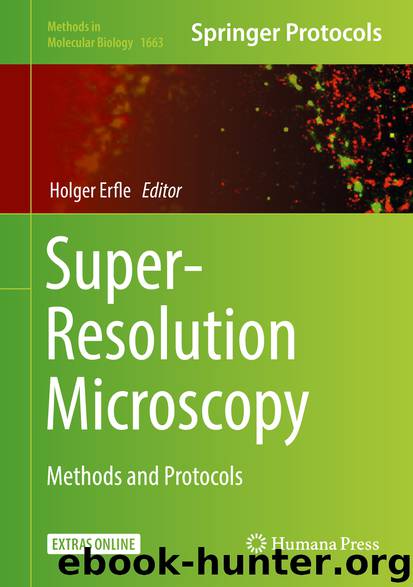 Super-Resolution Microscopy by Holger Erfle
