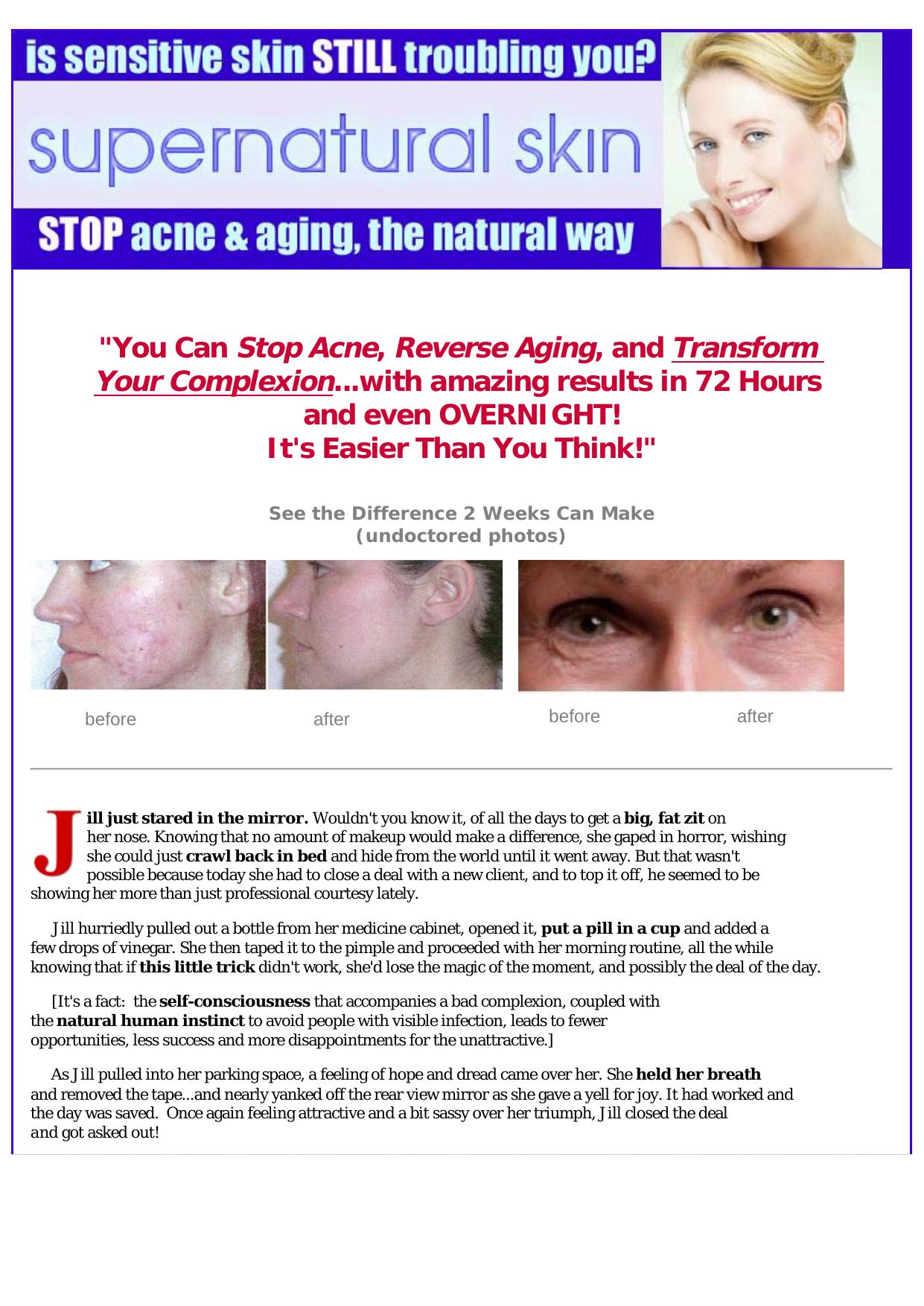 SuperNatural Solutions To Adult Acne And Aging. by Best of Kuszter's Collection